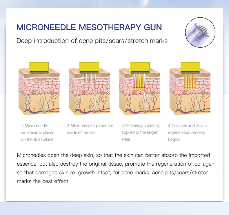 Nano Meso Gun Mesotheraphy Injector | Skin Enhancement Treatments