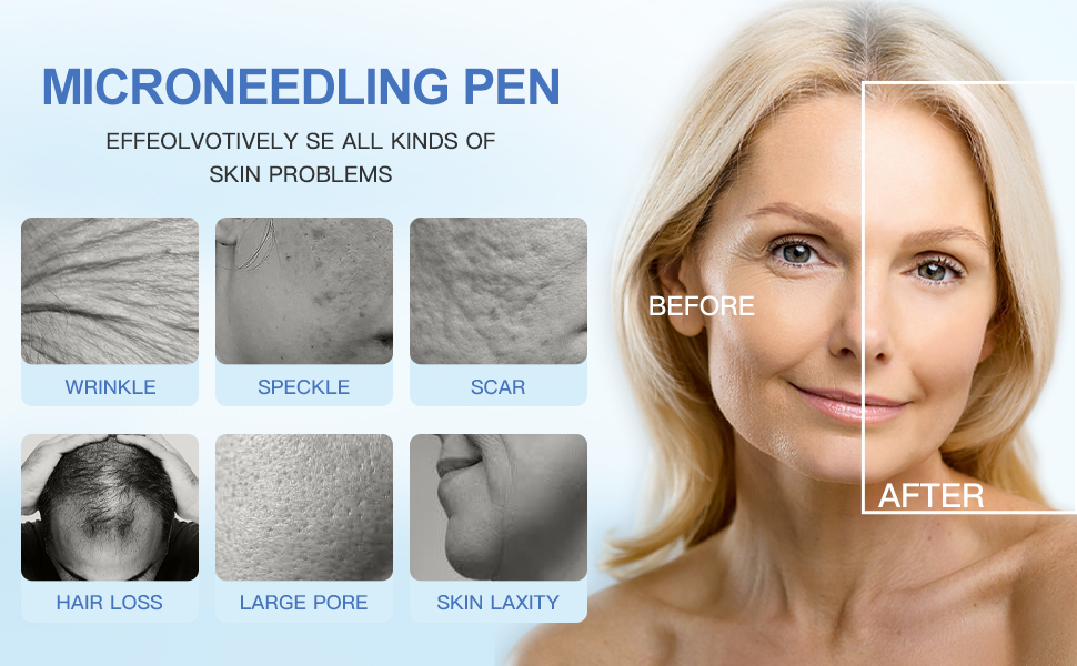 Dr.pen M8-W Wireless Microneedling Pen
