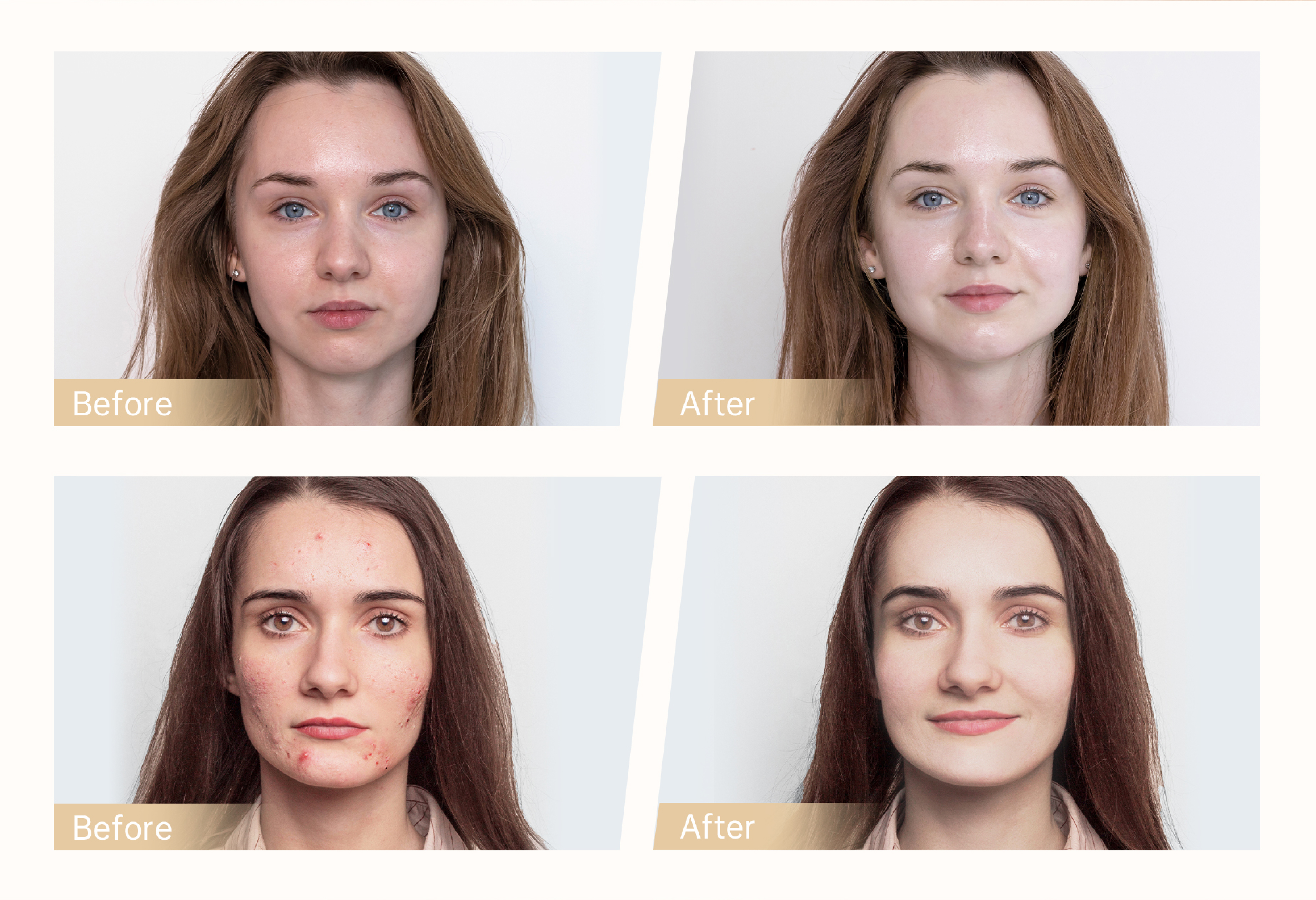 Dr.pen Hydra Pen H5 Microneedling Pen