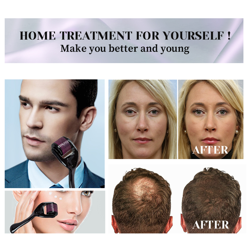 Dermal Roller 540 Microneedle for Hair Growth Remove Wrinkles