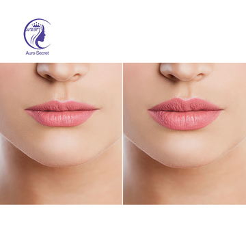 CE approved hyaluronic acid Fine Derm Deep Subskinha gel Face Fullness 1ml 2ml 10ml injectable dermal fillers body injection