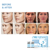 Meso Secret® Skinbooster Hyaluronic Acid 3.5ml * 2 Vials