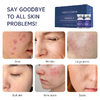 Meso Secret Exosomes for Cell Revival Skin Regeneration